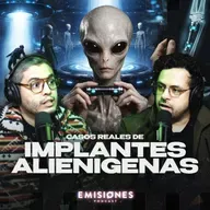 CASOS REALES de IMPLANTES ALIENÍGENAS