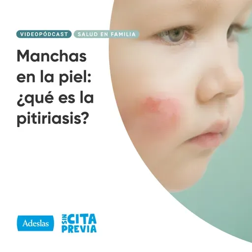 Manchas en la piel: ¿qué es la pitiriasis?