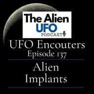 The Alien Implant Phenomenon