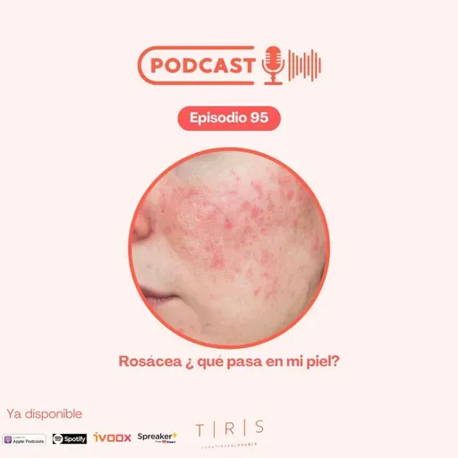 95 - Rosácea, ¿qué pasa en mi piel?
