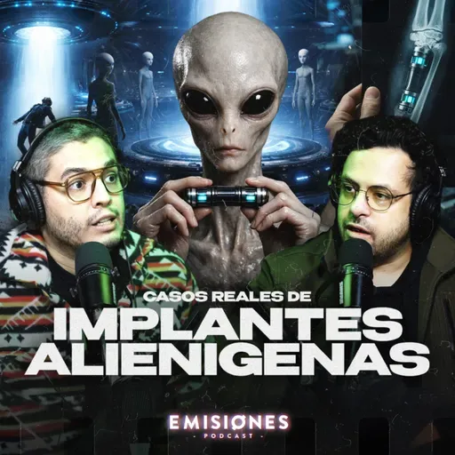CASOS REALES de IMPLANTES ALIENÍGENAS