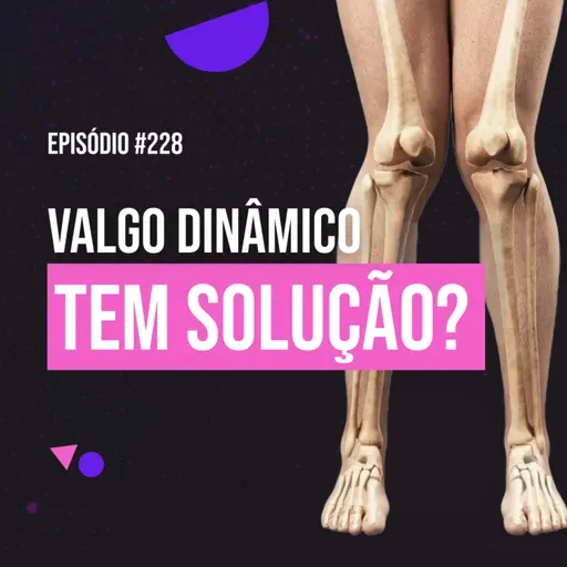 Ep. 228 - Tudo sobre Valgo Dinâmico: por que acontece e como corrigir de verdade