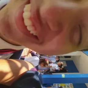 Elchupaculoturbolaser
