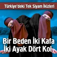 Bir Beden İki Kafa İki Ayak Dört Kol - Siyam İkizleri