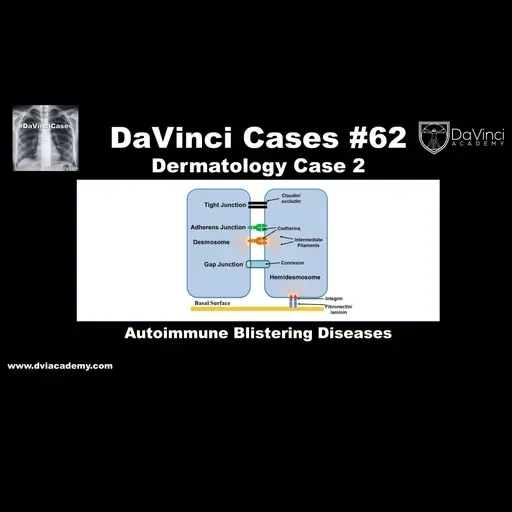 Autoimmune Blistering Diseases [#DaVinciCases Dermatology Case 2]