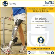 Las prótesis un nuevo comienzo