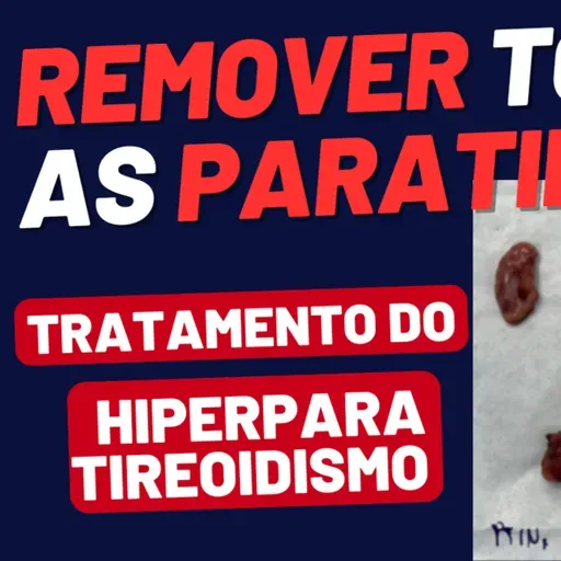 Retirada Total da Tireoide e das 4 Paratireoides: Como Fica a Saúde Depois da Cirurgia?