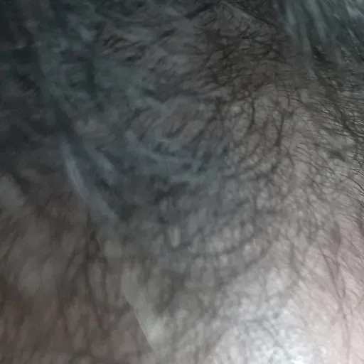 Assimindo a Calvície aos 25