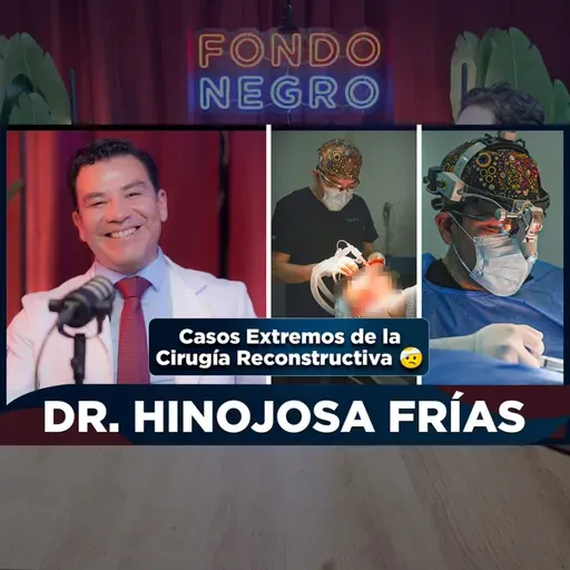 EP ESPECIAL - DR. HINOJOSA FRÍAS / Detrás de la Cirugía Reconstructiva, Cirugía Plástica, Casos Extremos, Pasión