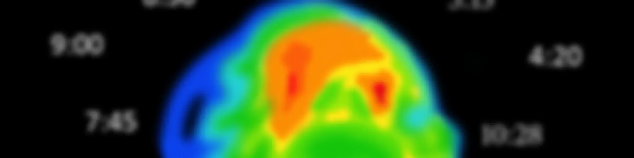 Procastinadores Anonimos