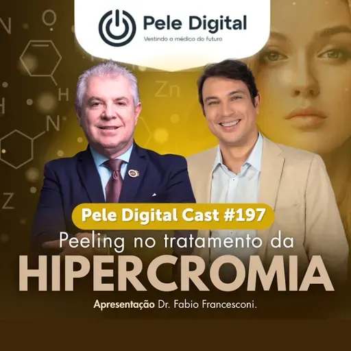 Pele Digital Cast #197 - Peeling no tratamento da hipercromia