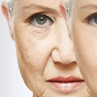 Khuôn mặt 'già nhanh' hé lộ tiên lượng ở bệnh nhân ung thư mô qua AI