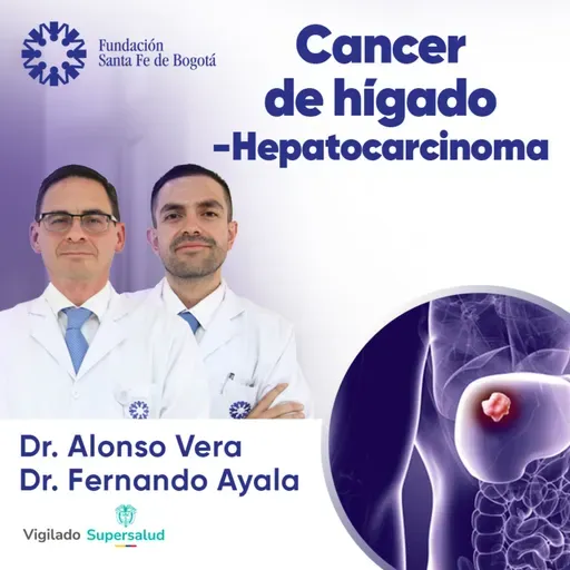 #168 Cáncer de hígado - Hepatocarcinoma