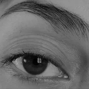 blackeyes