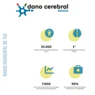 Ent. Carla Miranda, responsable de proxectos de Dano Cerebral Galicia | Dano Cerebral Adquirido