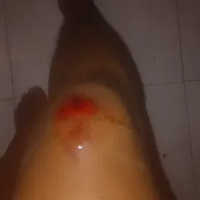 Pablito