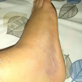 Alexfear