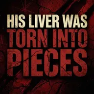 His Liver Was Torn Into Pieces | Abu Bakr Zoud