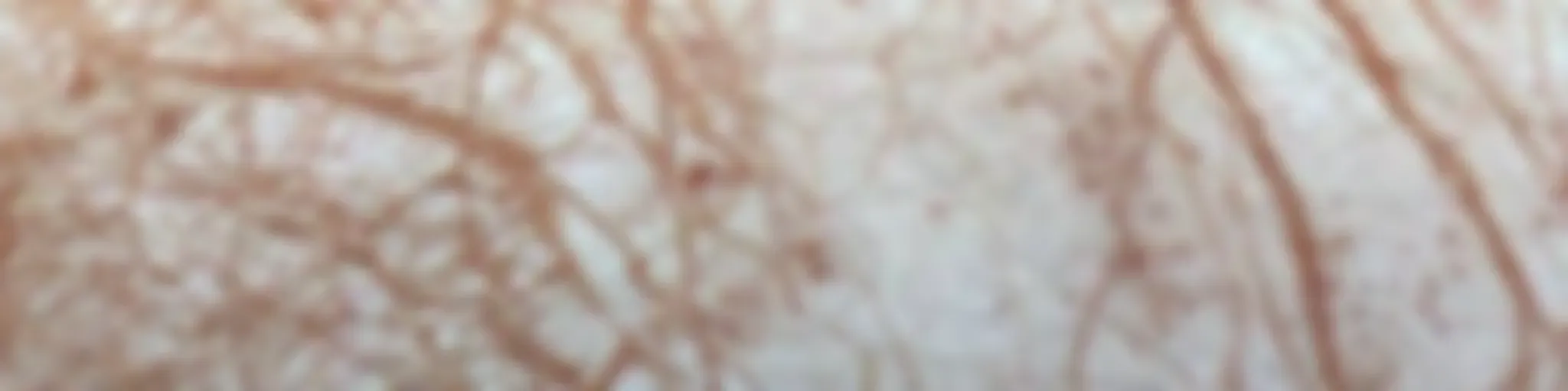 *“Yesterday, I Went to Mars ♡”*