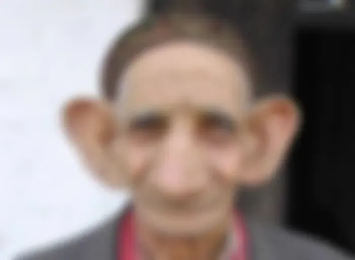 Aca