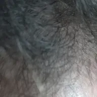 Assimindo a Calvície aos 25