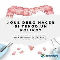 ¿Que Hacer Si Tengo Un Polipo?