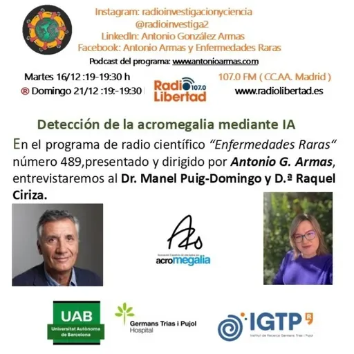 Detección de la acromegalia mediante IA