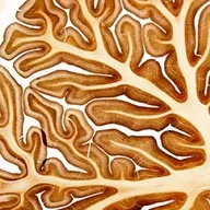 Episodio 84. ¿Qué es la neuroinflamación?