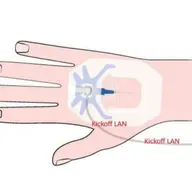 Inject the LAN Directly Into My Veins