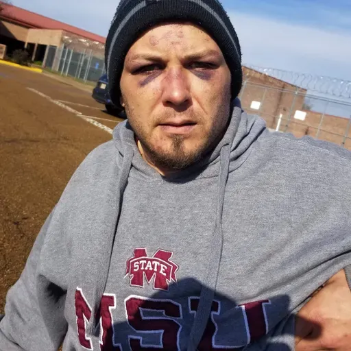 In a Mississippi Jail, Inmates Became Weapons