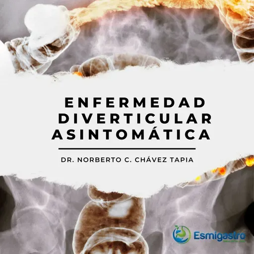 Enfermedad diverticular asintomática