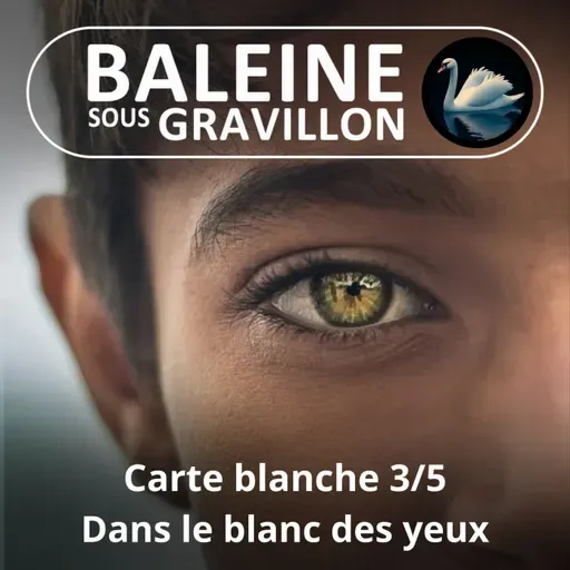 S05E123 Carte blanche 3/5 : Dans le blanc des yeux, c'est sclère et net