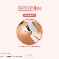 94 - El ABCDE del melanoma