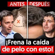 Dr. Experto en Pelo: Evita la calvicie y recupera tu pelo con estos simples pasos