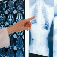 Sois los primeros: El cuidado de la salud ósea en España