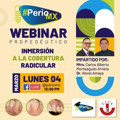 Webinar Propedéutico - Inmersión a la Cobertura Radicular