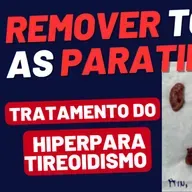 Retirada Total da Tireoide e das 4 Paratireoides: Como Fica a Saúde Depois da Cirurgia?