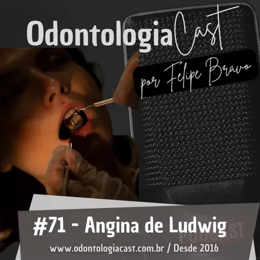 71 #Infecções Odontogênicas - Angina de Ludwig