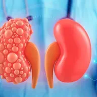 Cuando el riñón crece en silencio. Hablamos con Mónica Furlano.