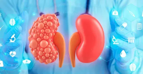 Cuando el riñón crece en silencio. Hablamos con Mónica Furlano.