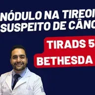 NÓDULO NA TIREOIDE = CÂNCER, COMO SABER? COMO TRATAR?
