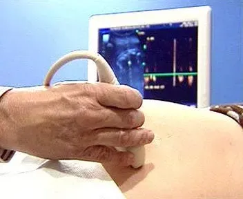 ¿Cómo gestionar la infertilidad?