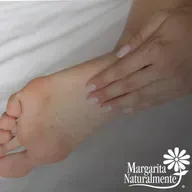 Resequedad en los talones