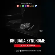 EPISODE 31 - BRUGADA SYNDROME | DEATH IN SLEEP | MALAYALAM PODCAST BEYPORESULTAN
