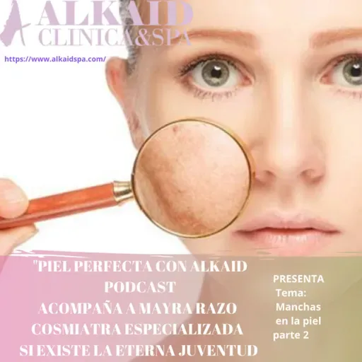 Piel Perfecta con Alkaid Presenta Manchas en la piel parte 2