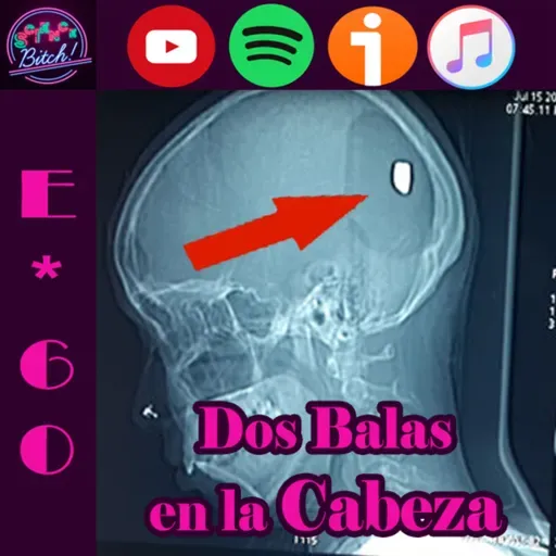 E*60 | Dos Balas en la Cabeza