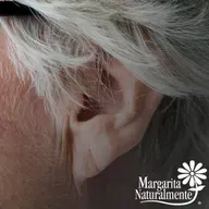 Resequedad en la piel y acidez estomacal