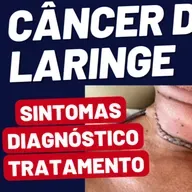 Câncer de Laringe: Como Reconhecer os Sintomas e Garantir o Tratamento Correto