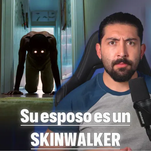 SU ESPOSO ES UN SKINWALKER