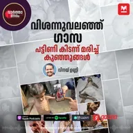 ഗാസയിൽ പട്ടിണികിടന്ന് മരിച്ച് കുഞ്ഞുങ്ങൾ